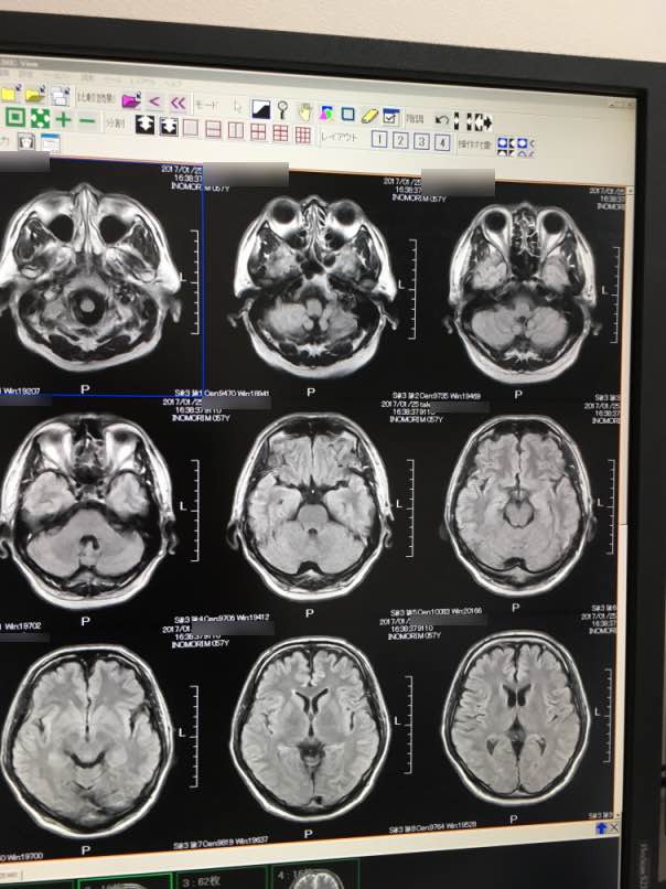 mri2017001.jpg